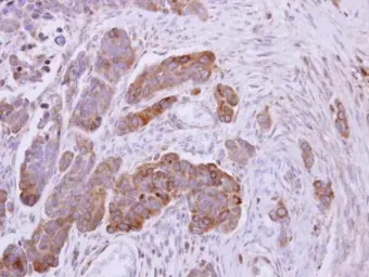Anti-NDUFS1 antibody used in IHC (Paraffin sections) (IHC-P). GTX105270