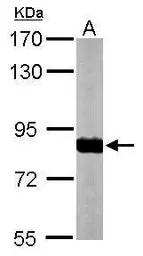 Anti-NDUFS1 antibody used in Western Blot (WB). GTX105270
