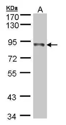 Anti-NDUFS1 antibody used in Western Blot (WB). GTX105270