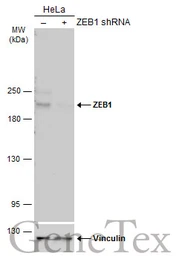 Anti-ZEB1 antibody [N2C1], Internal used in Western Blot (WB). GTX105278