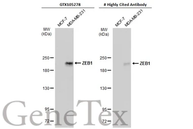 Anti-ZEB1 antibody [N2C1], Internal used in Western Blot (WB). GTX105278