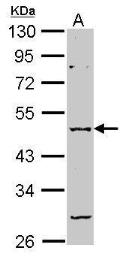 Anti-GABA A Receptor alpha 2 antibody [N1C2] used in Western Blot (WB). GTX105282