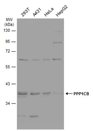 Anti-PPP1CB antibody used in Western Blot (WB). GTX105295