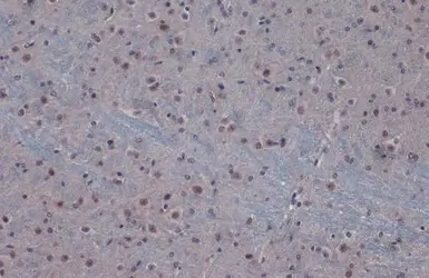 Anti-PPP1CB antibody used in IHC (Paraffin sections) (IHC-P). GTX105295