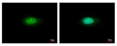 Anti-Annexin VII antibody used in Immunocytochemistry/ Immunofluorescence (ICC/IF). GTX105298