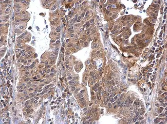 Anti-Annexin VII antibody used in IHC (Paraffin sections) (IHC-P). GTX105298