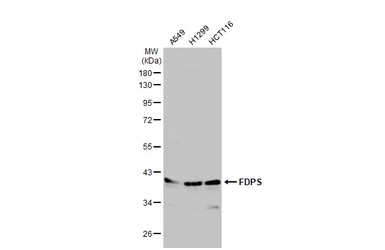 Anti-FDPS antibody [N1C3] used in Western Blot (WB). GTX105301