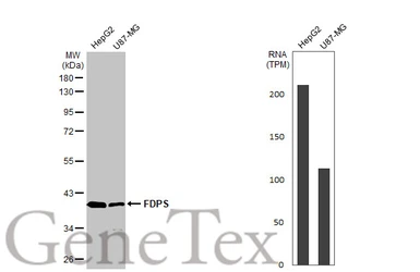 Anti-FDPS antibody [N1C3] used in Western Blot (WB). GTX105301
