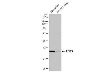 Anti-FDPS antibody [N1C3] used in Western Blot (WB). GTX105301
