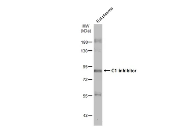 Anti-C1 inhibitor antibody [N1C3] used in Western Blot (WB). GTX105316