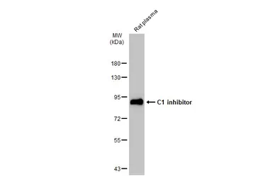 Anti-C1 inhibitor antibody [N1C3] used in Western Blot (WB). GTX105316