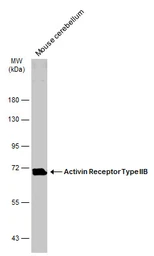 Anti-Activin Receptor Type IIB antibody [N1C1] used in Western Blot (WB). GTX105330