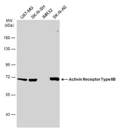 Anti-Activin Receptor Type IIB antibody [N1C1] used in Western Blot (WB). GTX105330