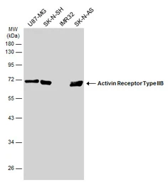 Anti-Activin Receptor Type IIB antibody [N1C1] used in Western Blot (WB). GTX105330