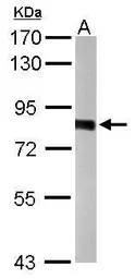 Anti-PWP2 antibody [N2C1], Internal used in Western Blot (WB). GTX105344