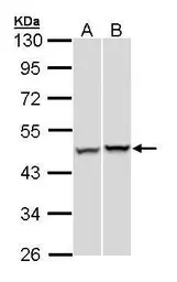 Anti-PSMC5 antibody used in Western Blot (WB). GTX105347