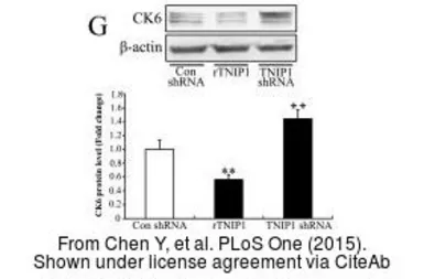 Anti-Cytokeratin 6 antibody used in Western Blot (WB). GTX105355