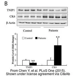 Anti-Cytokeratin 6 antibody used in Western Blot (WB). GTX105355
