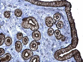 Anti-Cytokeratin 6 antibody used in IHC (Paraffin sections) (IHC-P). GTX105355