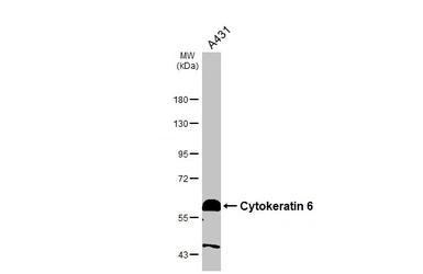 Anti-Cytokeratin 6 antibody used in Western Blot (WB). GTX105355