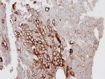 Anti-Cytokeratin 6 antibody used in IHC (Paraffin sections) (IHC-P). GTX105355