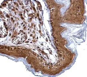 Anti-XPD antibody [N2C2], Internal used in IHC (Paraffin sections) (IHC-P). GTX105357