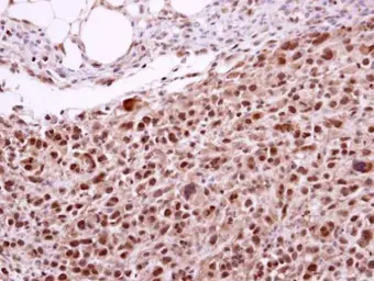 Anti-XPD antibody [N2C2], Internal used in IHC (Paraffin sections) (IHC-P). GTX105357