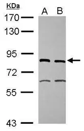 Anti-XPD antibody [N2C2], Internal used in Western Blot (WB). GTX105357