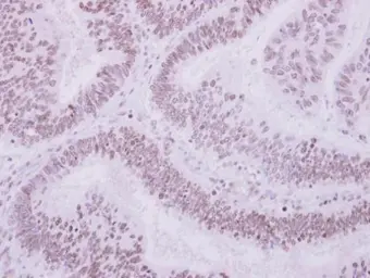 Anti-ULK4 antibody [N2C1], Internal used in IHC (Paraffin sections) (IHC-P). GTX105365