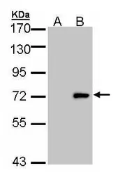 Anti-ULK4 antibody [N2C1], Internal used in Western Blot (WB). GTX105365