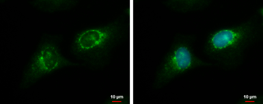 Anti-RGS7 antibody used in Immunocytochemistry/ Immunofluorescence (ICC/IF). GTX105382