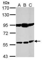 Anti-Bestrophin 1 antibody used in Western Blot (WB). GTX105387