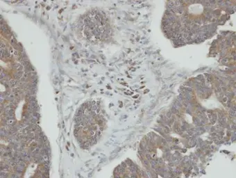 Anti-PPM1K antibody [N1C3] used in IHC (Paraffin sections) (IHC-P). GTX105394