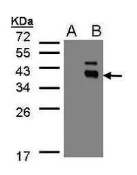 Anti-PPM1K antibody [N1C3] used in Western Blot (WB). GTX105394