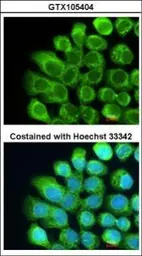 Anti-C2 / C2a antibody [N3C3] used in Immunocytochemistry/ Immunofluorescence (ICC/IF). GTX105404