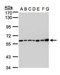 Anti-C2 / C2a antibody [N3C3] used in Western Blot (WB). GTX105404