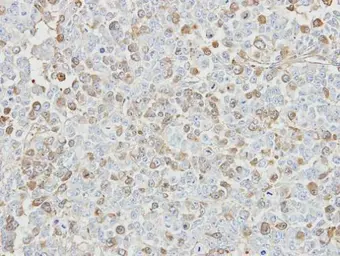 Anti-USP5 antibody [C1C3] used in IHC (Paraffin sections) (IHC-P). GTX105407