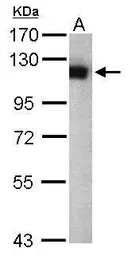 Anti-USP5 antibody [C1C3] used in Western Blot (WB). GTX105407