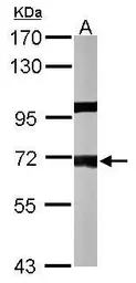 Anti-PPP1R16A antibody [N1C3] used in Western Blot (WB). GTX105410