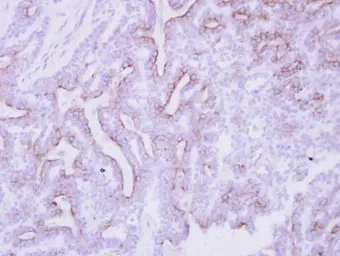Anti-CDON / CDO antibody [N1N2], N-term used in IHC (Paraffin sections) (IHC-P). GTX105422