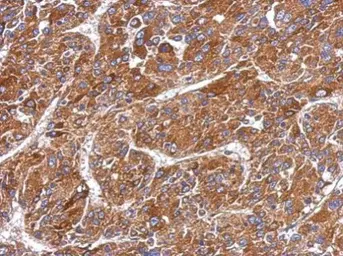 Anti-MMP8 antibody used in IHC (Paraffin sections) (IHC-P). GTX105428