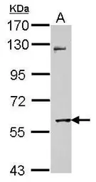 Anti-MMP8 antibody used in Western Blot (WB). GTX105428