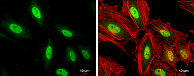 Anti-MEF2C antibody used in Immunocytochemistry/ Immunofluorescence (ICC/IF). GTX105433