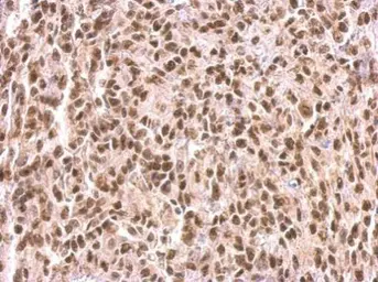 Anti-MEF2C antibody used in IHC (Paraffin sections) (IHC-P). GTX105433