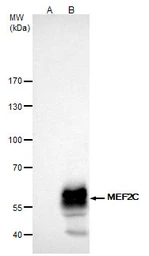 Anti-MEF2C antibody used in Immunoprecipitation (IP). GTX105433