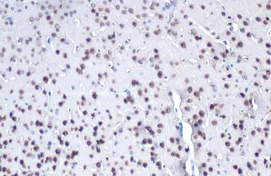 Anti-MEF2C antibody used in IHC (Paraffin sections) (IHC-P). GTX105433