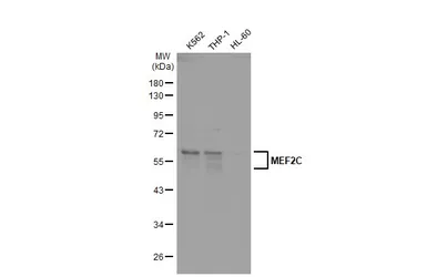 Anti-MEF2C antibody used in Western Blot (WB). GTX105433