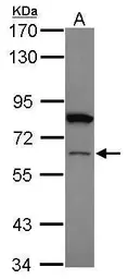 Anti-ZNF449 antibody used in Western Blot (WB). GTX105470