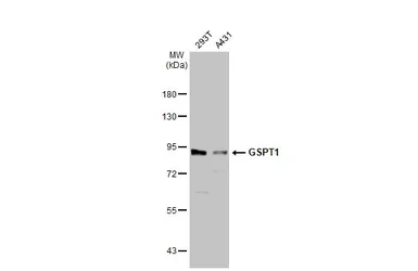 Anti-GSPT1 antibody used in Western Blot (WB). GTX105475