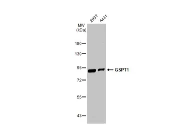 Anti-GSPT1 antibody used in Western Blot (WB). GTX105475